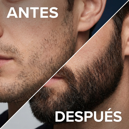 growthserum™ - crecimiento para barba y pelo